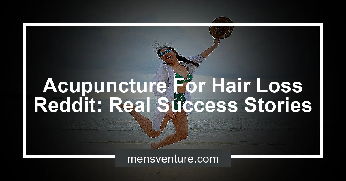 Acupuncture For Hair Loss Reddit Real Success Stories Men's Venture